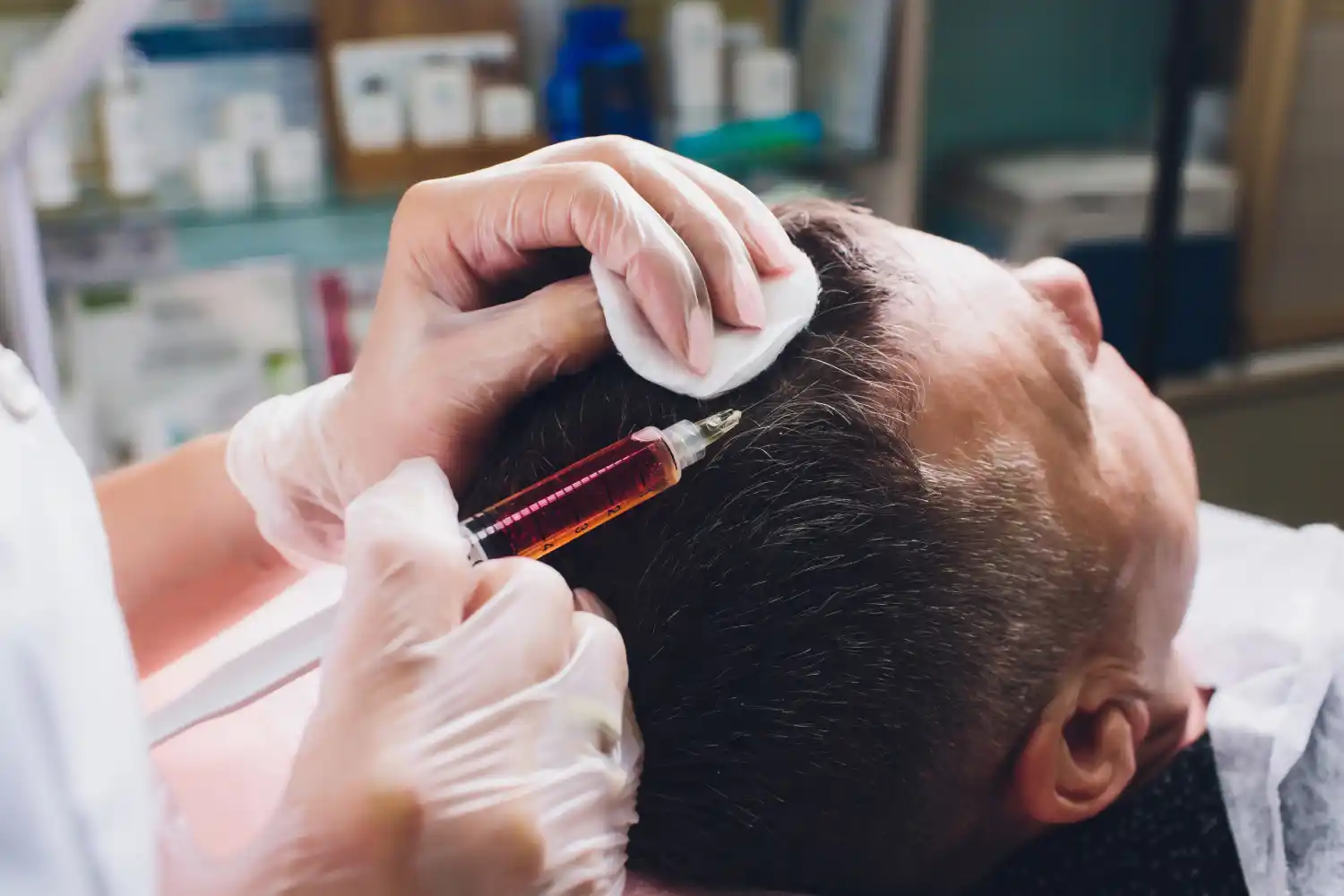 hair transplant in Bilaspur