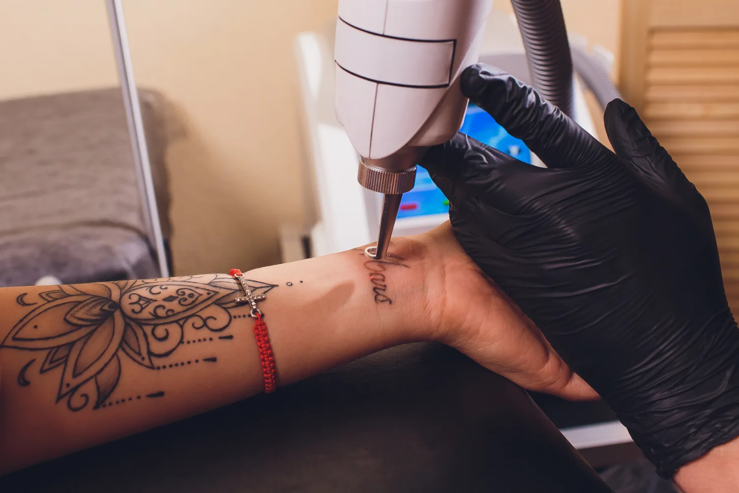 tattoo removal in Bilaspur
