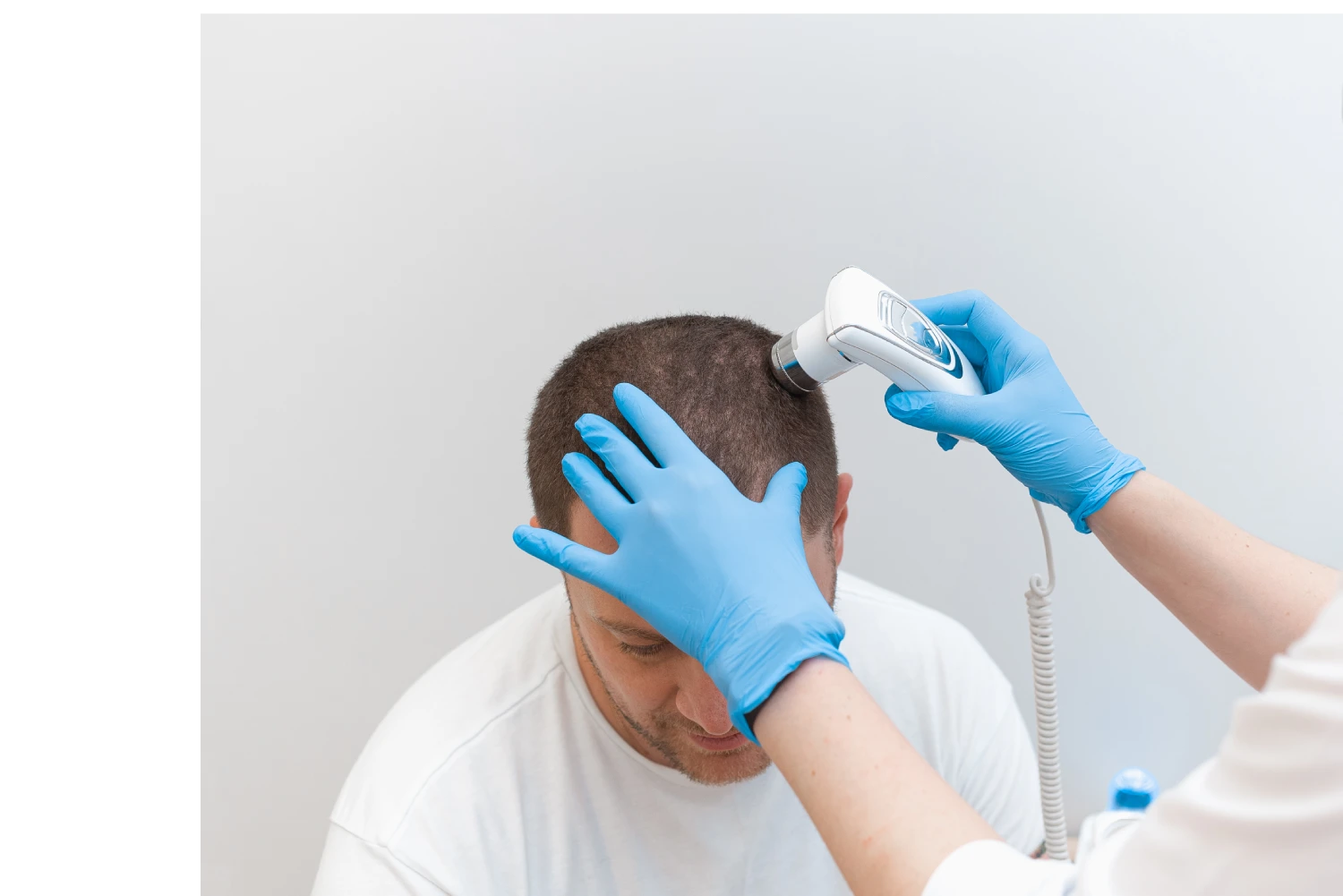 Can Bilaspur Offer A Professional Hair Transplant As In Metro Cities?